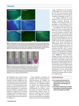 Originalien
Gewebekulturschale PP- Plättchen
TitanChrom
Cobalt Molybdän
Krumeich-Ring
a b
c d
e f g
200 µm 200 µm
200 µm 200 µm
200 µm 200 µm200 µm
Abb. 9 8 HMVEC haften an undwachsen auf demintrastromalen kornealenKrumeich-Ring.Darge-
stelltsindhierHMVEC,dieaufdemReferenzmaterial(aZellkulturkunststoﬀschale,bPP-Plättchen)den
einzelnen Komponenten des Krumeich-Rings (c,d,e,f)unddem Krumeich-Ring selbst(g)wachsen.
Lebende Zellen sind grün undrote Zellen sind rot angefärbt. Der Maßstabsbalken entspricht200 μm.
HMVEC menschliche dermale mikrovaskuläre Endothelzellen von erwachsenenSpendern
Abb. 10 8 OptischesErscheinungsbildderExtrakteausTitan-,Chrom-,Mo-
lybdän- undCobaltmetallpulververglichen mitdemWachstumsmedium.
Von linksnach rechts: Titan-,Chrom-,Molybdän- undCobaltmetallpulver
verglichen mit dem WachstumsmediumnachderFiltrierung durch einen
0,2 μm PVDF-FilterundvorderBenutzung im MTT-Test.MTT 3-(4,5-Dime-
thylthiazol-2-yl)-2,5-diphenyltetrazolium Bromid
den Zellbiologie waren motiviert durch
die scheinbare Unstimmigkeit in veröf-
fentlichten Arbeiten bezüglich der Aus-
wirkungen des intrastromalen kornealen
Krumeich-Rings auf das Gewebe der Pa-
tienten [1, 9]. Als Studienobjekt wurden
primäre menschliche dermale mikrovas-
kuläre Endothelzellen von erwachsenen
Spendern (HMVEC) ausgewählt, da die
publizierten Ergebnisse die Vermutung
nahelegen, dass die Entstehung von Neo-
vaskularisationen von einem unbeein-
trächtigtenStoﬀwechselderEndothelzel-
len abhängt [19].
Unsere Ergebnisse unterstützen die
Annahme, dass der intrastromale Kru-
meich-Kornearing die Viabilität von
HMVEC nicht beeinﬂusst. Eine höhere
Verdünnung von Molybdänmetallpul-
ver, welches in das Wachstumsmedium
eingegeben wurde, erhöht die Stoﬀ-
wechselaktivität von HMVEC. Außer-
dem haften und wachsen HMVEC am
Krumeich-Ring. Während unsere Er-
gebnisse in Einklang mit der Annahme
sind, dass keine negativen Auswirkun-
geninunseremModellsystemaufgedeckt
werden, sind weitere Versuchsdurchfüh-
rungen erforderlich, um die scheinbare
Unstimmigkeit in der Literatur bezüg-
lich der nach dem klinischen Einsatz
des intrastromalen Krumeich-Rings be-
schriebenen Wirkungen zu lösen [1, 9].
Als mögliche Erklärung für dieses
Phänomen wird die noch nicht voll-
ständig verstandene Biochemie von
Molybdän in menschlichen Zellen vor-
geschlagen, (s. hierzu Plitzko et al. [13]
und die darin enthaltenen Referenzen).
Die Ergebnisse des MTT-Tests sind
jedoch im Lichte von Limitierungen des
MTT-Tests zu sehen: Verbindungen, die
den pH des Mediums verändern, sowie
die Sensitivität der untersuchten Zellen
gegenüber den eingesetzten Materialien
müssen berücksichtigt werden. Die ein-
gesetzten dermalen Zellen sind hier als
Modell für die stromale Umgebung des
Ringes in der Kornea hinreichend als
Studienobjekt, jedoch nicht direkt auf
die stromale Umgebung der Kornea in
Patienten übertragbar. Weiterhin ist von
besonderer Relevanz, dass in unseren
Untersuchungen eine Farbänderung des
Mediums nach Erstellung von löslichen
Extrakten von Metallpulvern beobachtet
wurde (. Abb. 10). Weitere Untersu-
chungen sind daher notwendig, um die
beobachteten Phänomene mit den oben
genannten Limitierungen einerseits auf
die zugrunde liegenden zellbiologischen
Mechanismen zurückzuführen und an-
dererseits durch weitere Modellversuche
auf eine breitere Basis zu stellen. Zudem
sind die Zeiträume in die Überlegungen
einzubeziehen. In dieser Studie wurden
Inkubationen über 5 Tage betrachtet,
während der Ring über Jahre im Patien-
ten verbleiben kann.
Fazit für die Praxis
4 Der intrastromale korneale Kru-
meich-Ring übt keine messbaren
zytotoxischen Auswirkungen auf
HMVEC aus.
4 Eine höhere Verdünnung von Molyb-
dänextrakten im Wachstumsmedium
erhöht die Viabilität von HMVEC.
Der Ophthalmologe
 