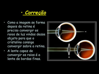 • Correção
• Como a imagem se forma
depois da retina é
preciso convergir os
raios de luz vindos desse
objeto para que o
cristalino consiga
convergir sobre a retina.
• A lente capaz de
convergir os raios é a
lente de bordas finas.
 