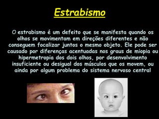 O estrabismo é um defeito que se manifesta quando os
olhos se movimentam em direções diferentes e não
conseguem focalizar juntos o mesmo objeto. Ele pode ser
causado por diferenças acentuadas nos graus de miopia ou
hipermetropia dos dois olhos, por desenvolvimento
insuficiente ou desigual dos músculos que os movem, ou
ainda por algum problema do sistema nervoso central
Estrabismo
 