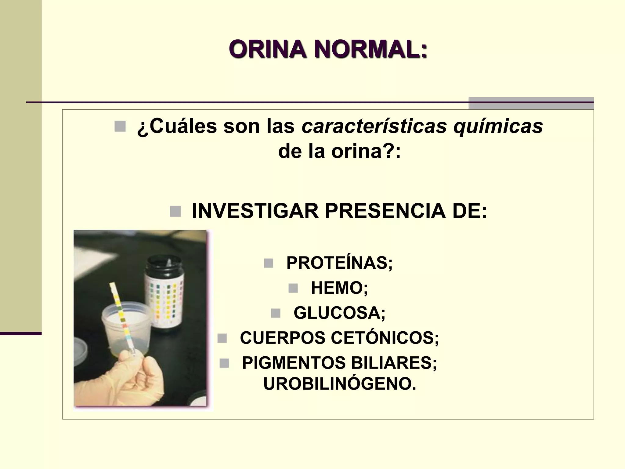 ORINA NORMAL:


 ¿Cuáles son las características químicas
                de la orina?:

      INVESTIGAR PRESENCIA DE:

               PROTEÍNAS;
                  HEMO;
                GLUCOSA;
           CUERPOS CETÓNICOS;
           PIGMENTOS BILIARES;
              UROBILINÓGENO.
 