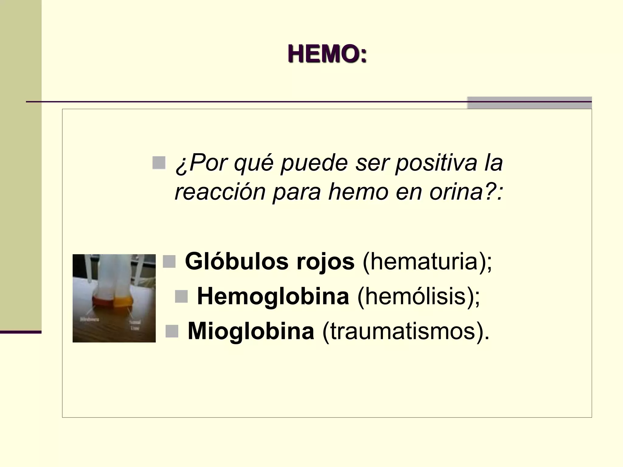 HEMO:



 ¿Por qué puede ser positiva la
  reacción para hemo en orina?:

 Glóbulos rojos (hematuria);
   Hemoglobina (hemólisis);
  Mioglobina (traumatismos).
 