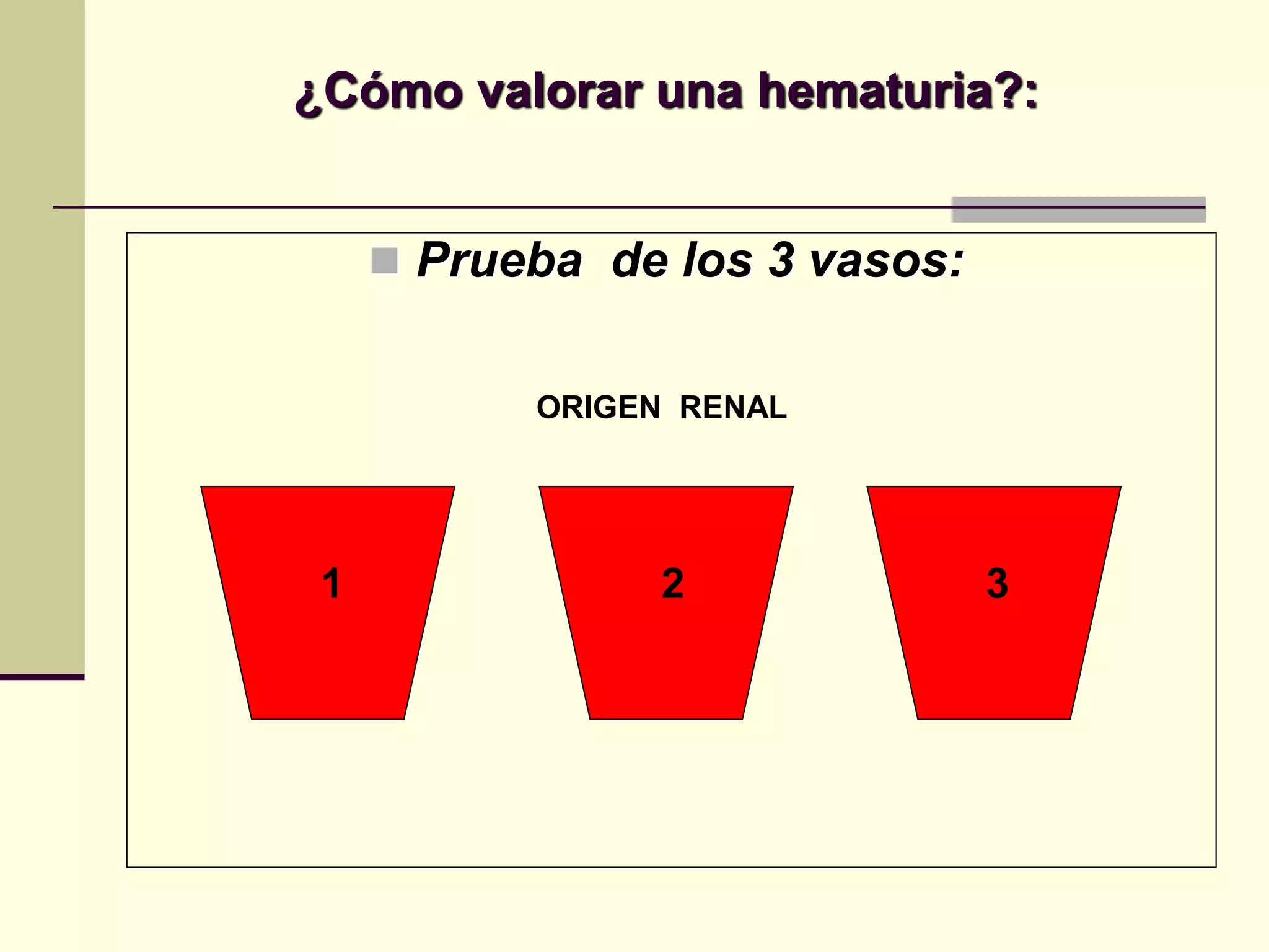 ¿Cómo valorar una hematuria?:


      Prueba de los 3 vasos:


           ORIGEN RENAL




 1              2               3
 