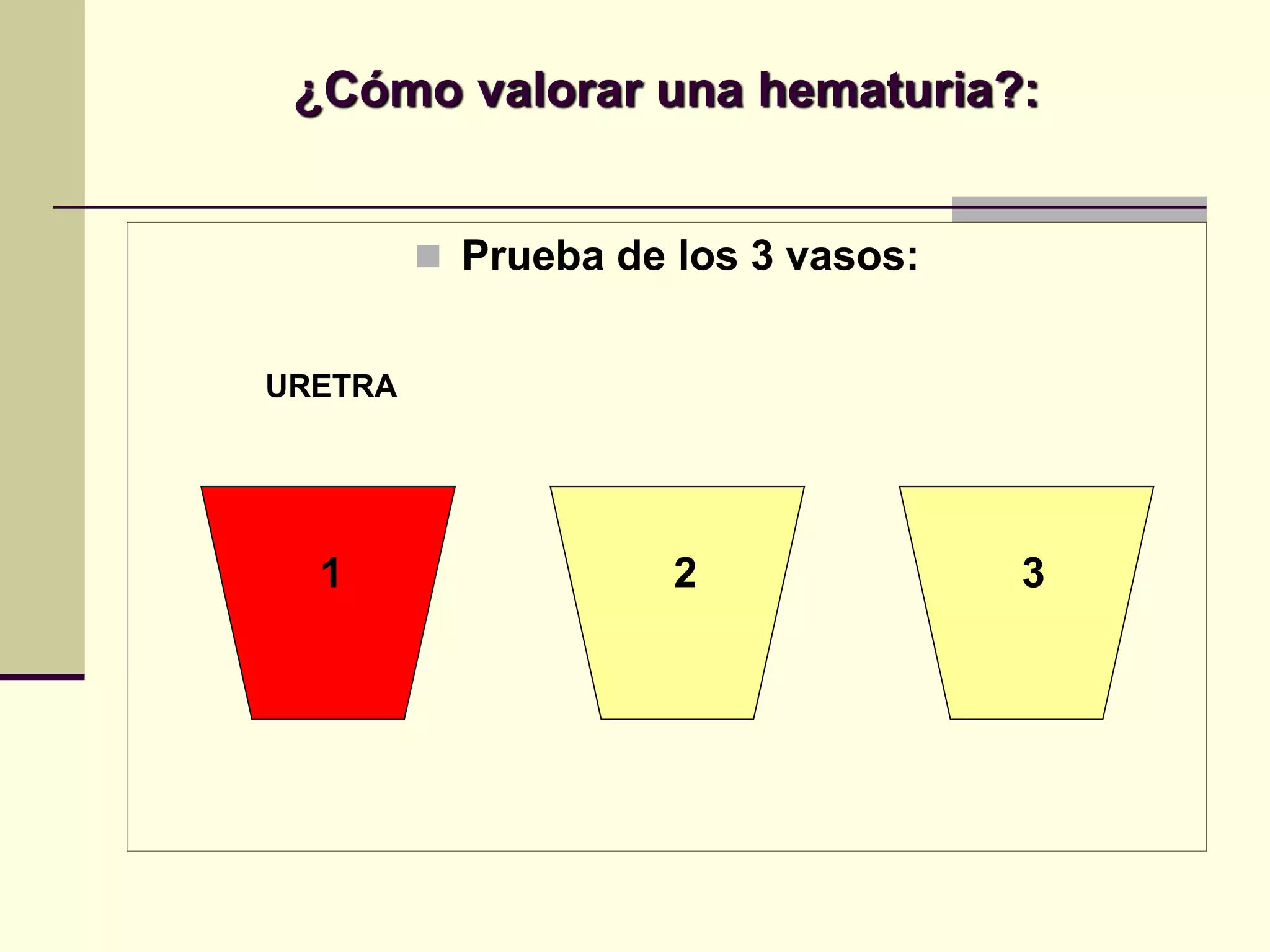 ¿Cómo valorar una hematuria?:


          Prueba de los 3 vasos:


URETRA




  1                  2              3
 