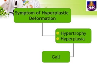 Symptom of Hyperplastic
Deformation

Hypertrophy
Hyperplasia

Gall

 