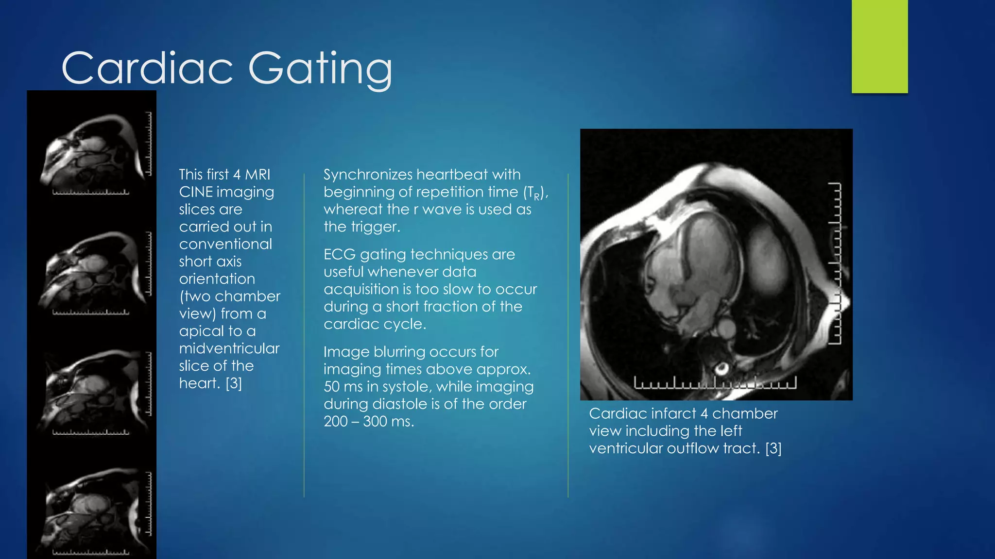 Cardiac Gating
This first 4 MRI
CINE imaging
slices are
carried out in
conventional
short axis
orientation
(two chamber
view) from a
apical to a
midventricular
slice of the
heart. [3]
Synchronizes heartbeat with
beginning of repetition time (TR),
whereat the r wave is used as
the trigger.
ECG gating techniques are
useful whenever data
acquisition is too slow to occur
during a short fraction of the
cardiac cycle.
Image blurring occurs for
imaging times above approx.
50 ms in systole, while imaging
during diastole is of the order
200 – 300 ms.
Cardiac infarct 4 chamber
view including the left
ventricular outflow tract. [3]
 