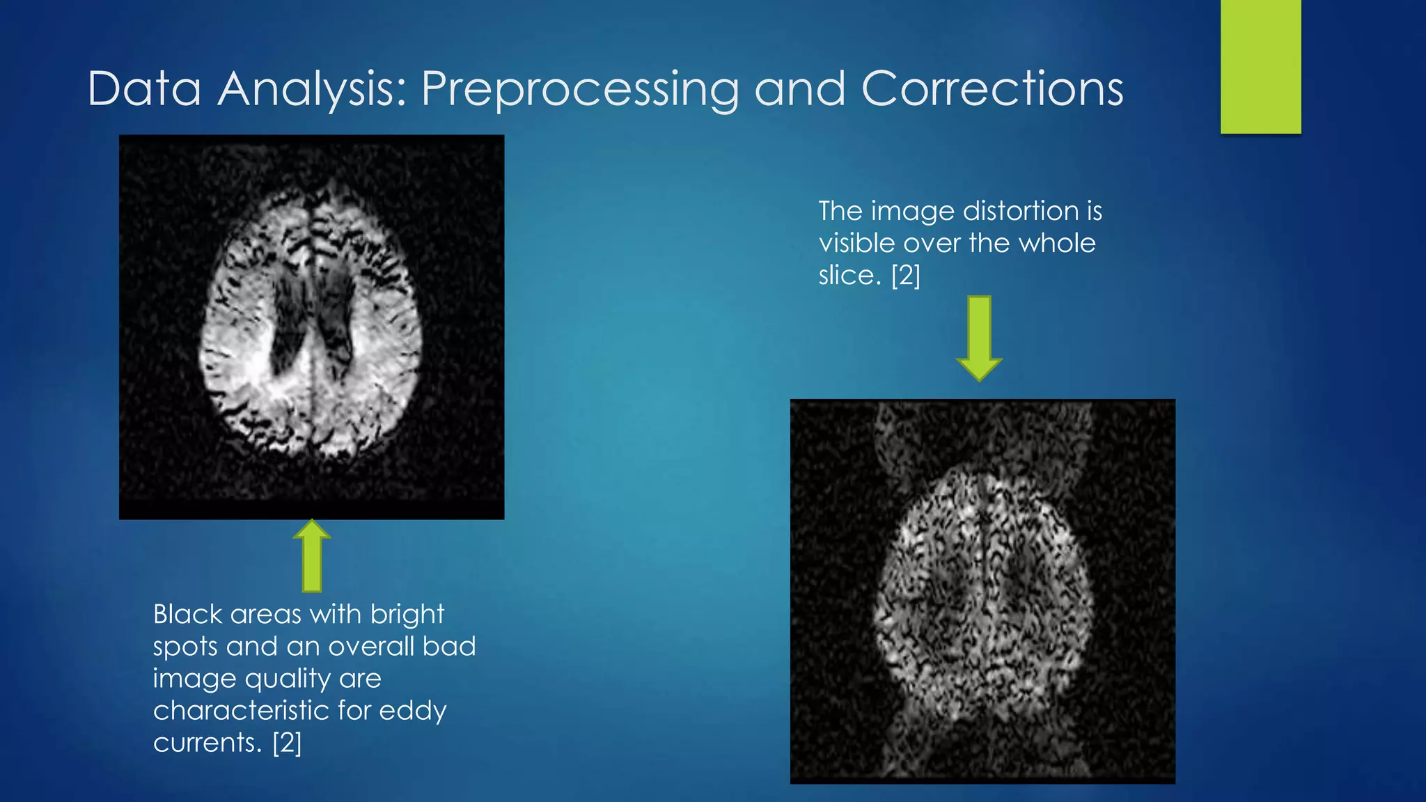 Data Analysis: Preprocessing and Corrections
Black areas with bright
spots and an overall bad
image quality are
characteristic for eddy
currents. [2]
The image distortion is
visible over the whole
slice. [2]
 