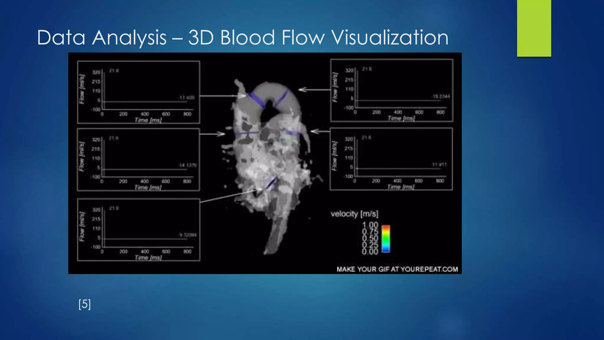 Data Analysis – 3D Blood Flow Visualization
[5]
 