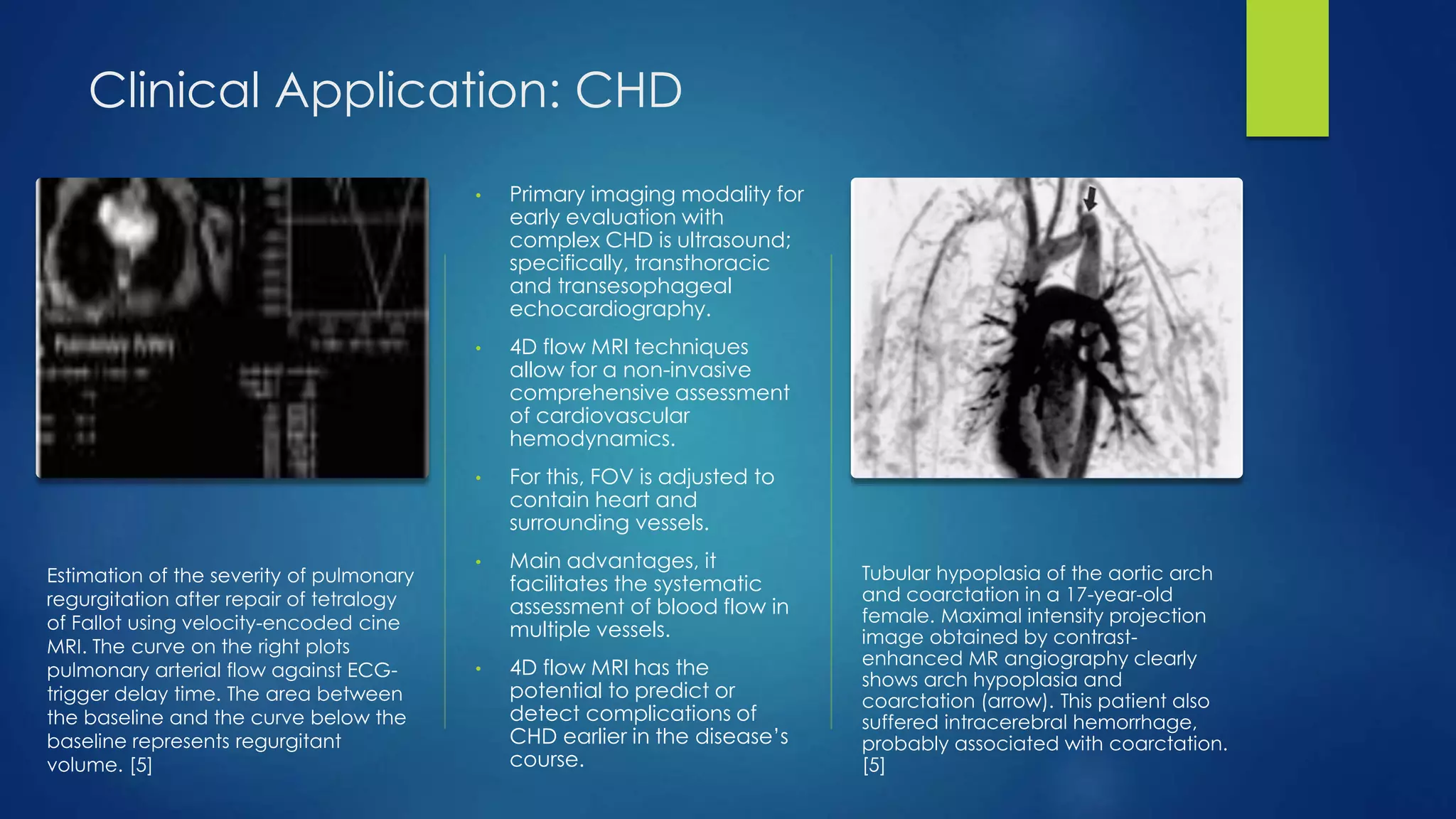 Clinical Application: CHD
Estimation of the severity of pulmonary
regurgitation after repair of tetralogy
of Fallot using velocity-encoded cine
MRI. The curve on the right plots
pulmonary arterial flow against ECG-
trigger delay time. The area between
the baseline and the curve below the
baseline represents regurgitant
volume. [5]
• Primary imaging modality for
early evaluation with
complex CHD is ultrasound;
specifically, transthoracic
and transesophageal
echocardiography.
• 4D flow MRI techniques
allow for a non-invasive
comprehensive assessment
of cardiovascular
hemodynamics.
• For this, FOV is adjusted to
contain heart and
surrounding vessels.
• Main advantages, it
facilitates the systematic
assessment of blood flow in
multiple vessels.
• 4D flow MRI has the
potential to predict or
detect complications of
CHD earlier in the disease’s
course.
Tubular hypoplasia of the aortic arch
and coarctation in a 17-year-old
female. Maximal intensity projection
image obtained by contrast-
enhanced MR angiography clearly
shows arch hypoplasia and
coarctation (arrow). This patient also
suffered intracerebral hemorrhage,
probably associated with coarctation.
[5]
 