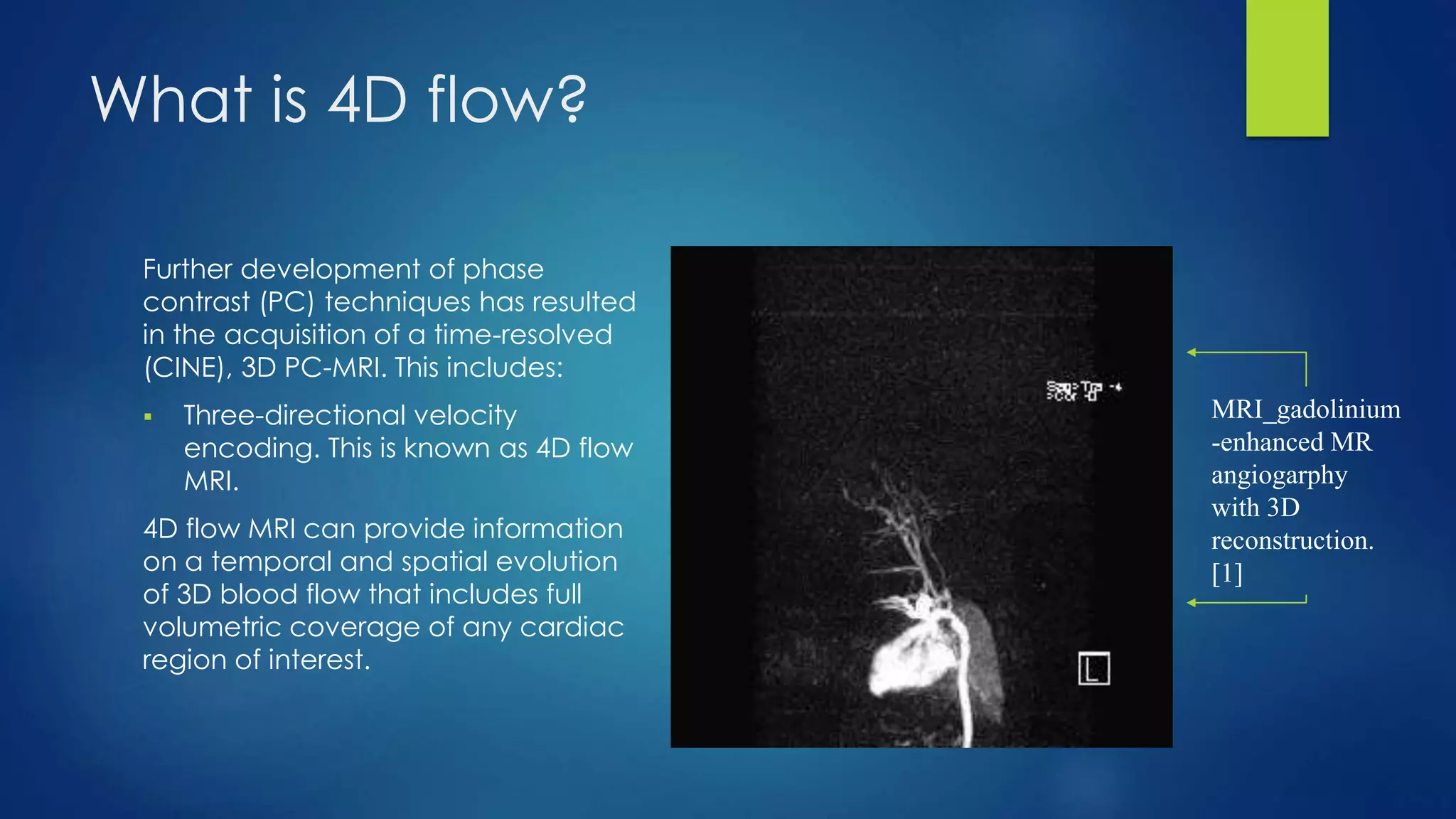What is 4D flow?
Further development of phase
contrast (PC) techniques has resulted
in the acquisition of a time-resolved
(CINE), 3D PC-MRI. This includes:
 Three-directional velocity
encoding. This is known as 4D flow
MRI.
4D flow MRI can provide information
on a temporal and spatial evolution
of 3D blood flow that includes full
volumetric coverage of any cardiac
region of interest.
MRI_gadolinium
-enhanced MR
angiogarphy
with 3D
reconstruction.
[1]
 