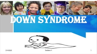 Down SynDromE
2/14/2022 1
Tesfalem.Y
 