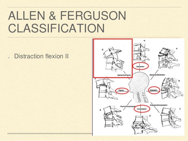 C5 C6 Dislocation C5 C6 Dislocation
