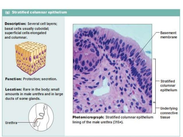 2. epithelial-t[1]