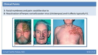 Ismail Fadhil Abbas, MD M.B.Ch.B
Anatomy of Trigeminal nerve
3- Facial numbness and pain: could be due to
B- Reactivation ofherpes varicellazoster virus (chickenpox) and it affects typicallyV1.
Clinical Points
 