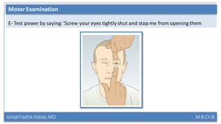 Ismail Fadhil Abbas, MD M.B.Ch.B
Anatomy of Trigeminal nerve
E- Test power by saying:‘Screw your eyes tightly shut and stop me from opening them
Motor Examination
 