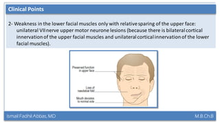 Ismail Fadhil Abbas, MD M.B.Ch.B
Anatomy of Trigeminal nerve
2- Weakness in the lower facial muscles only with relativesparing of the upper face:
unilateral VIInerve upper motor neurone lesions (because there is bilateralcortical
innervationof the upper facial muscles and unilateralcorticalinnervationof the lower
facial muscles).
Clinical Points
 