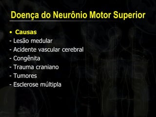 Doença do Neurônio Motor Superior 
•Causas 
- Lesão medular 
- Acidente vascular cerebral 
- Congênita 
- Trauma craniano 
- Tumores 
- Esclerose múltipla  