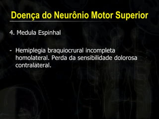 Doença do Neurônio Motor Superior 
4. Medula Espinhal 
-Hemiplegia braquiocrural incompleta homolateral. Perda da sensibilidade dolorosa contralateral.  