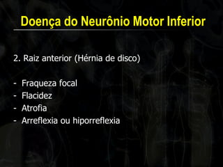 Doença do Neurônio Motor Inferior 
2. Raiz anterior (Hérnia de disco) 
-Fraqueza focal 
-Flacidez 
-Atrofia 
-Arreflexia ou hiporreflexia 
 