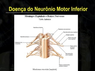 Doença do Neurônio Motor Inferior  