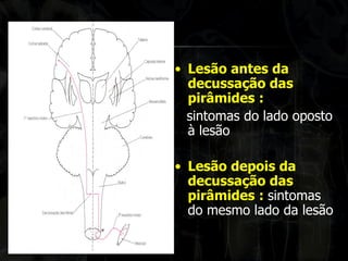 •Lesão antes da decussação das pirâmides : 
sintomas do lado oposto à lesão 
•Lesão depois da decussação das pirâmides : sintomas do mesmo lado da lesão  