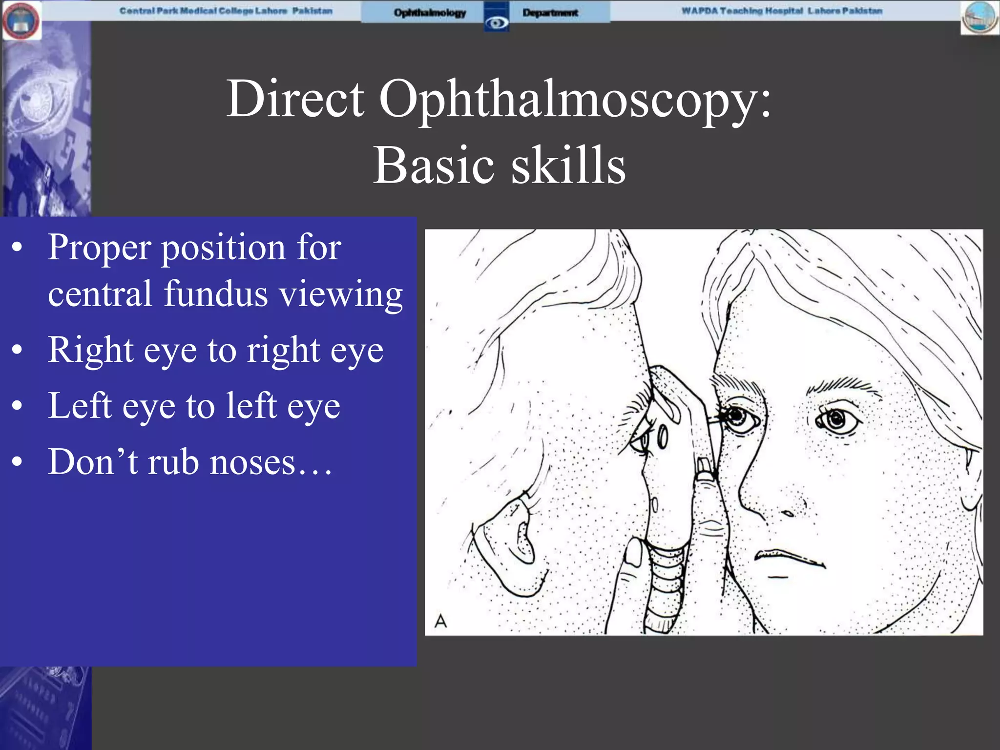 Direct Ophthalmoscopy:
Basic skills
• Proper position for
central fundus viewing
• Right eye to right eye
• Left eye to left eye
• Don’t rub noses…
 