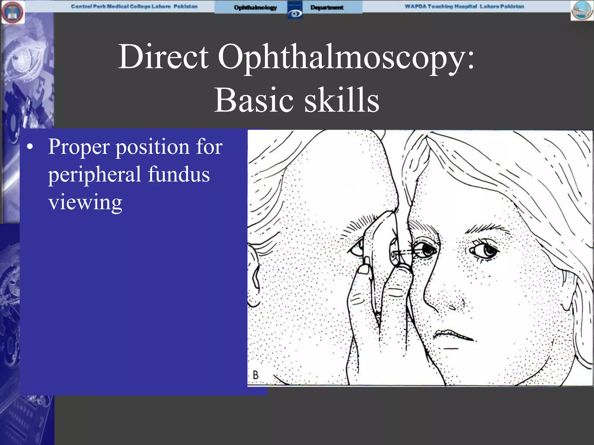 Direct Ophthalmoscopy:
Basic skills
• Proper position for
peripheral fundus
viewing
 
