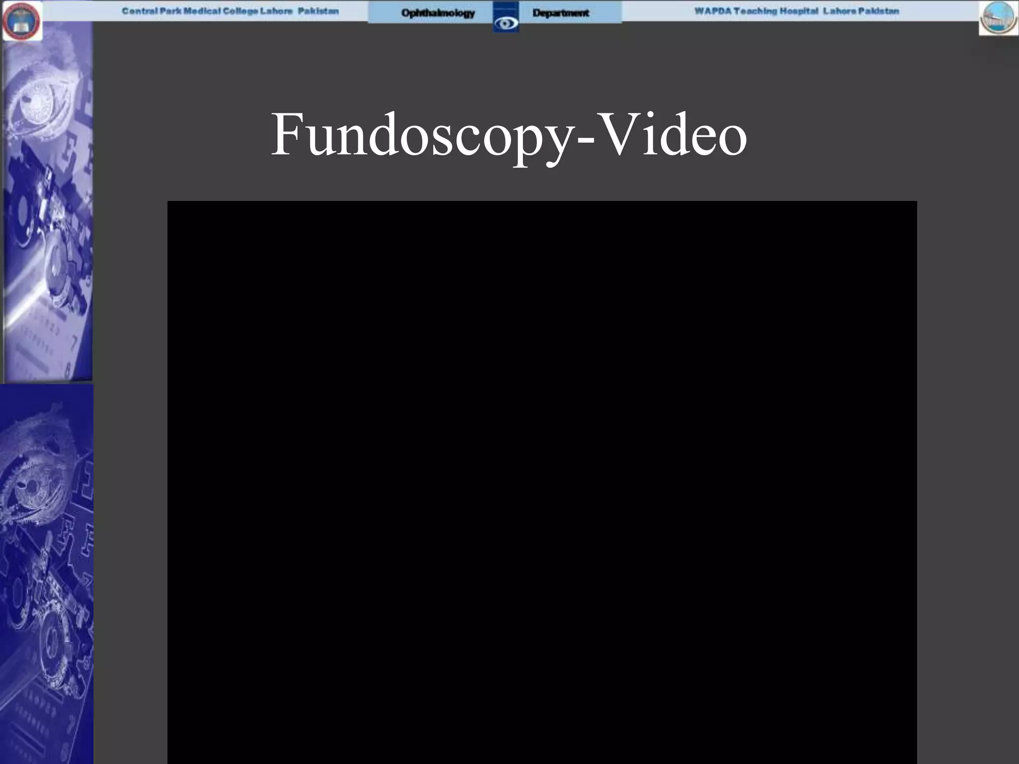 Fundoscopy-Video
 