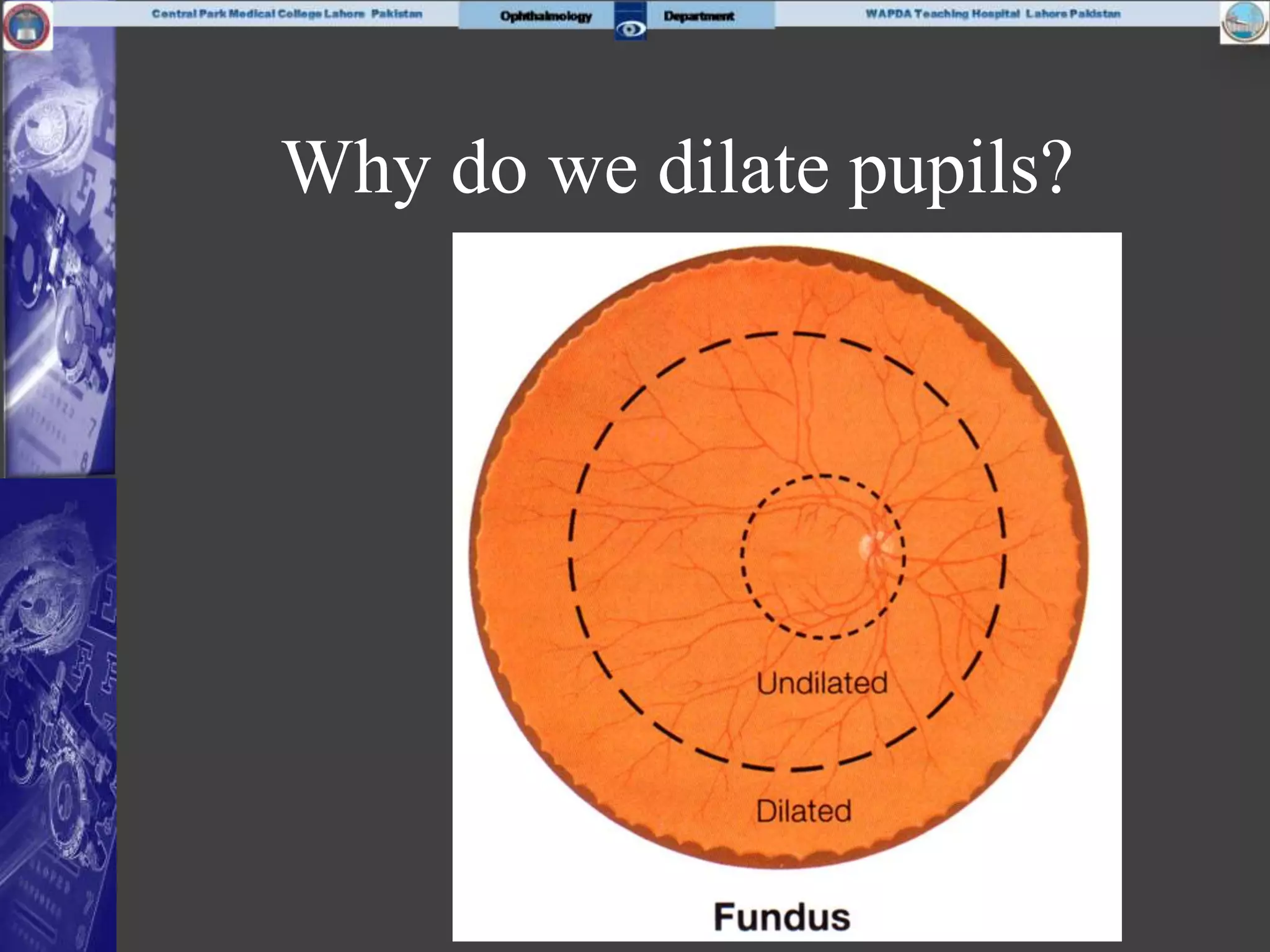 Why do we dilate pupils?
 