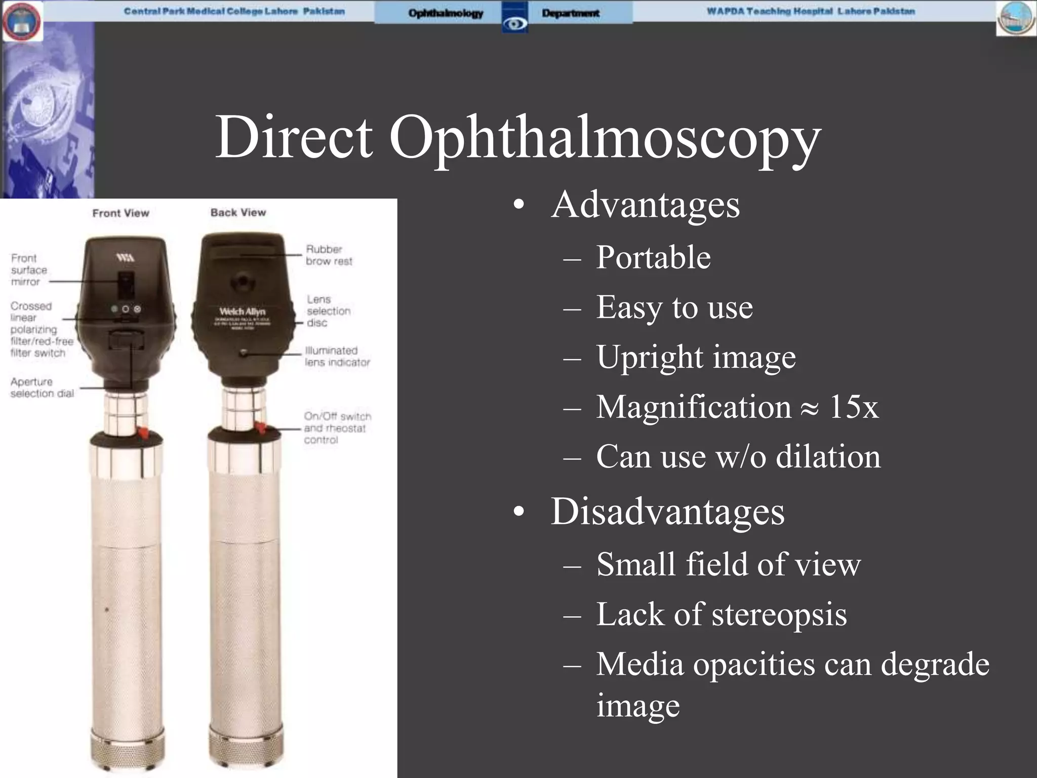 Direct Ophthalmoscopy
• Advantages
– Portable
– Easy to use
– Upright image
– Magnification  15x
– Can use w/o dilation
• Disadvantages
– Small field of view
– Lack of stereopsis
– Media opacities can degrade
image
 