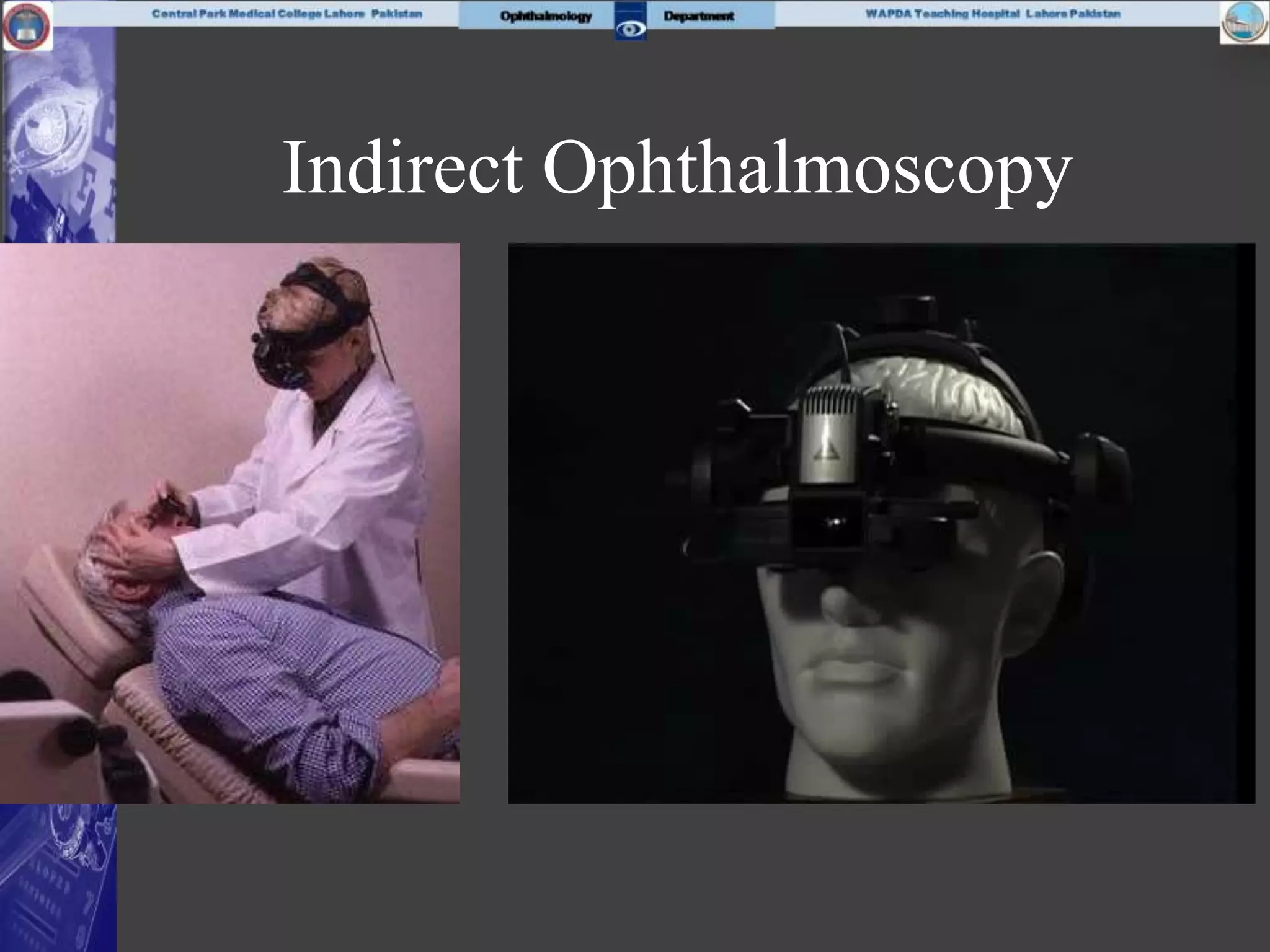 Indirect Ophthalmoscopy
 
