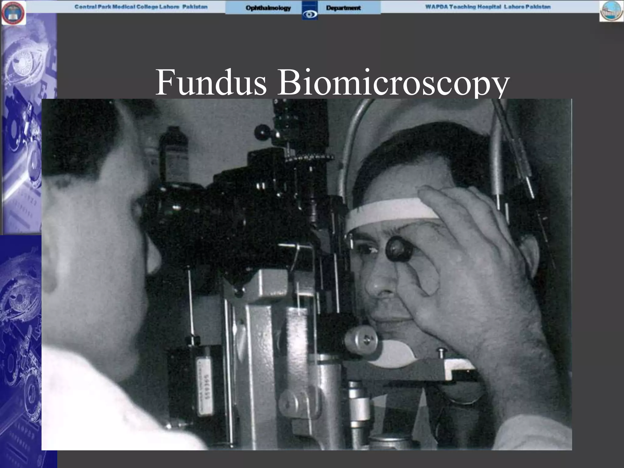 Fundus Biomicroscopy
 
