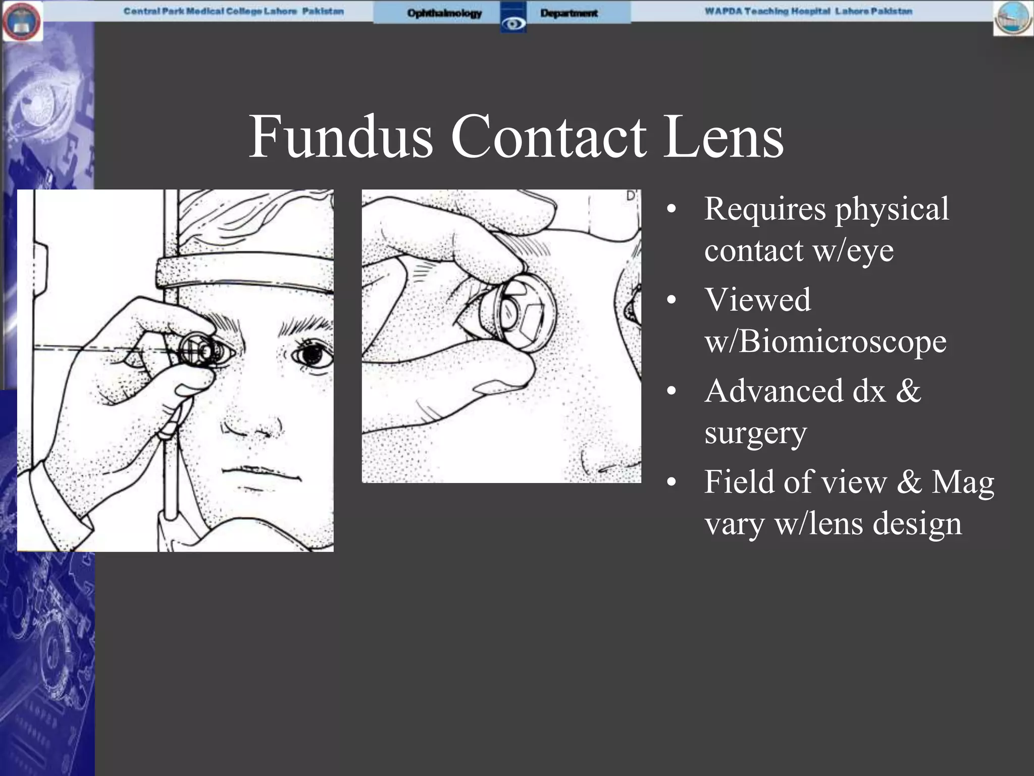 Fundus Contact Lens
• Requires physical
contact w/eye
• Viewed
w/Biomicroscope
• Advanced dx &
surgery
• Field of view & Mag
vary w/lens design
 