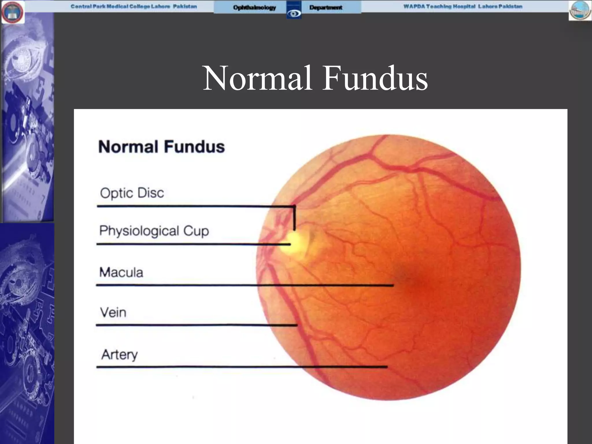 Normal Fundus
 