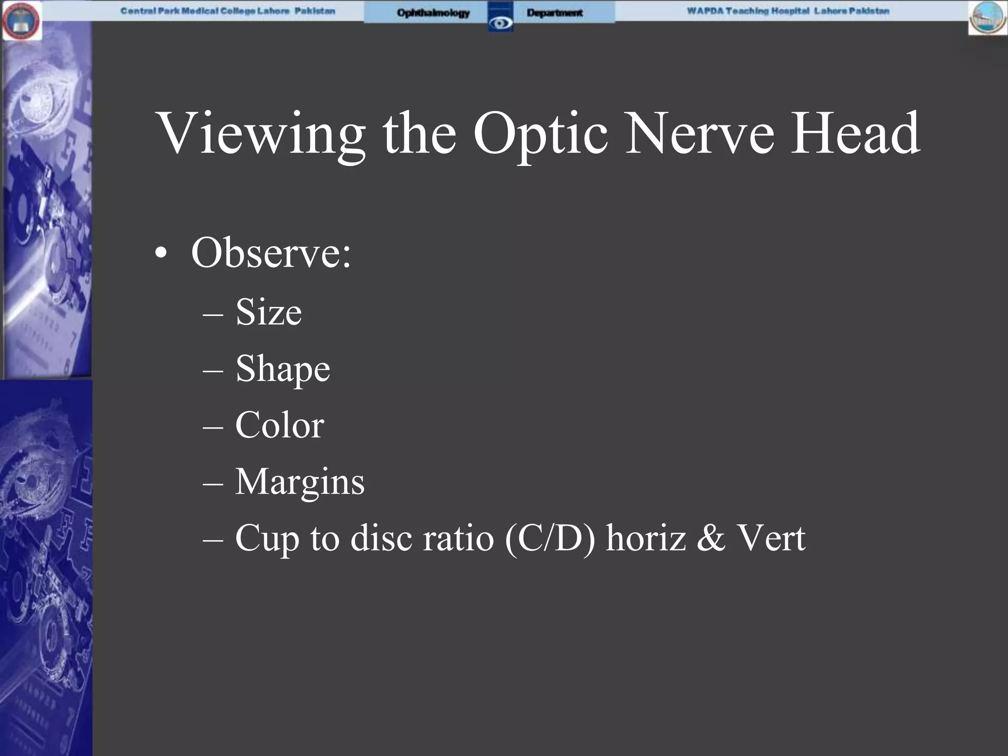 Viewing the Optic Nerve Head
• Observe:
– Size
– Shape
– Color
– Margins
– Cup to disc ratio (C/D) horiz & Vert
 
