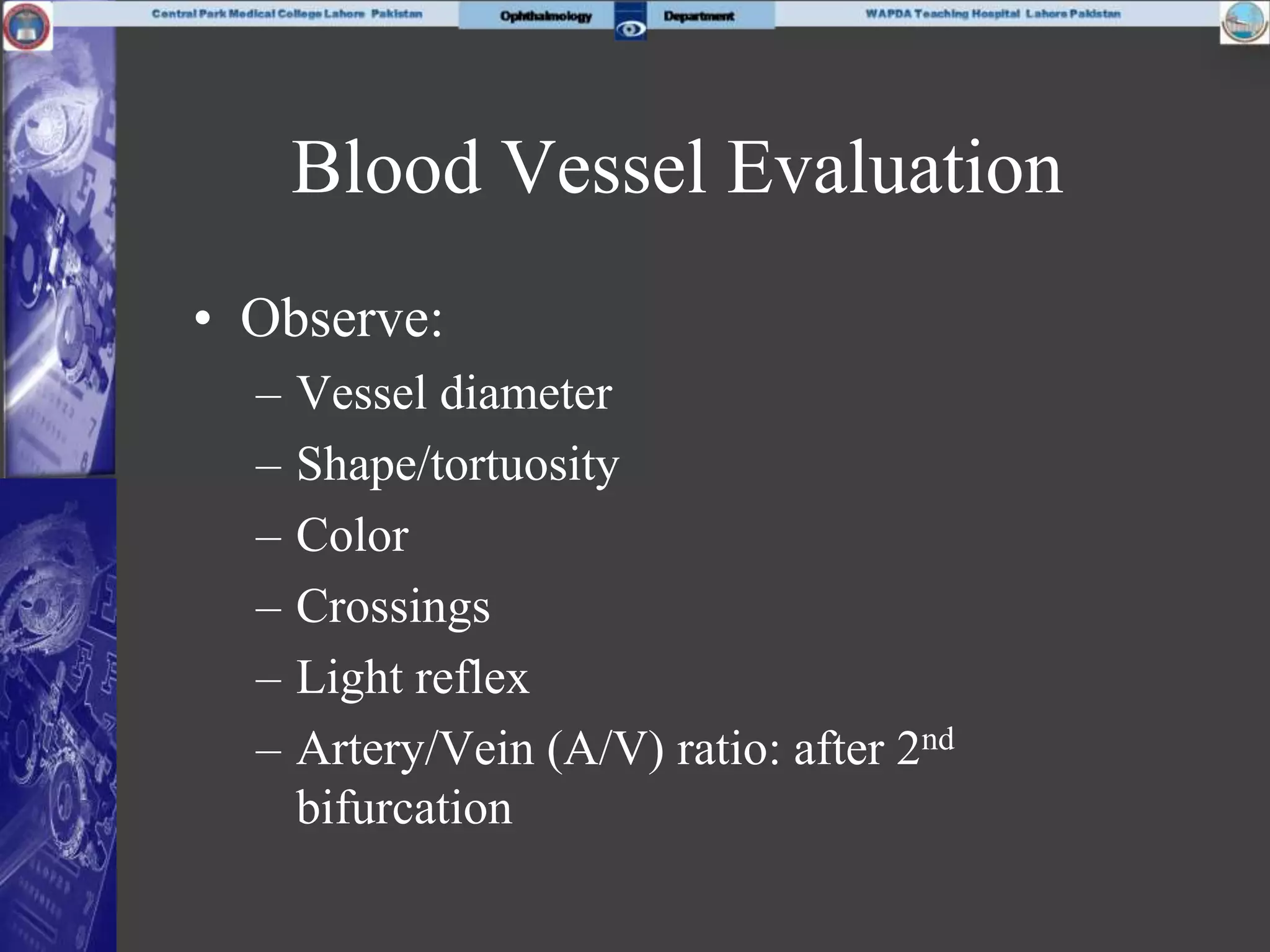 Blood Vessel Evaluation
• Observe:
– Vessel diameter
– Shape/tortuosity
– Color
– Crossings
– Light reflex
– Artery/Vein (A/V) ratio: after 2nd
bifurcation
 