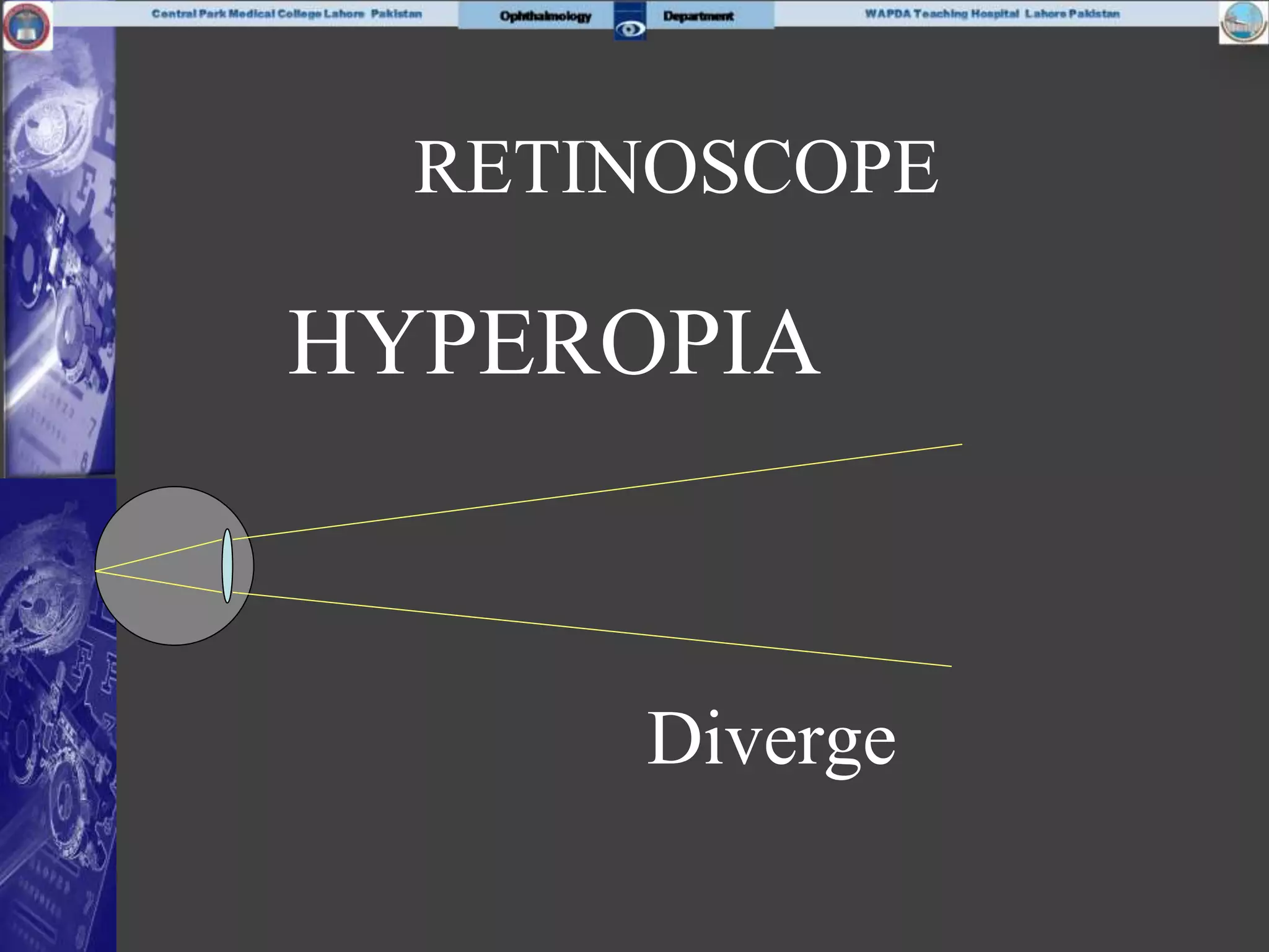 RETINOSCOPE
HYPEROPIA
Diverge
 