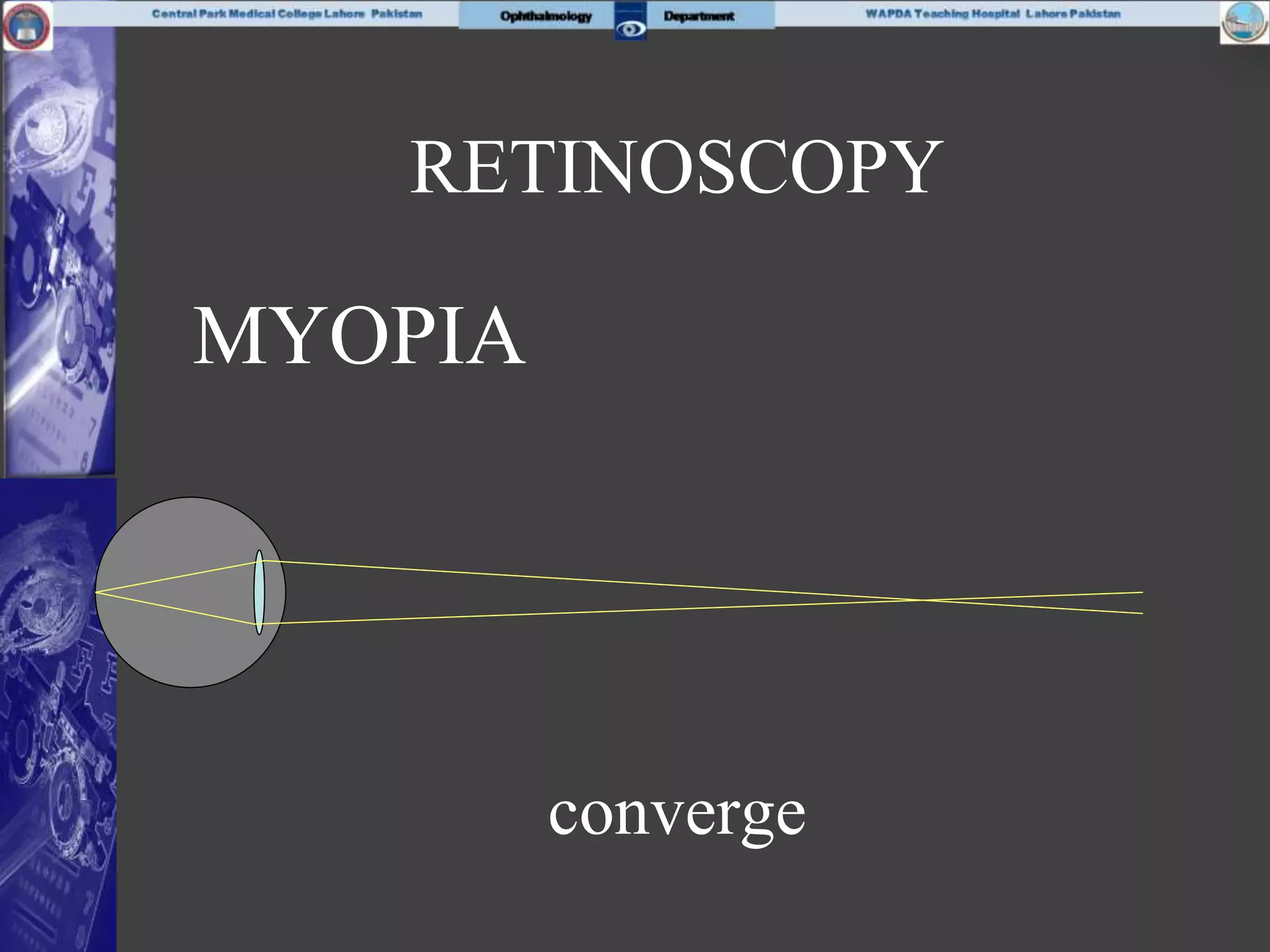 MYOPIA
converge
RETINOSCOPY
 