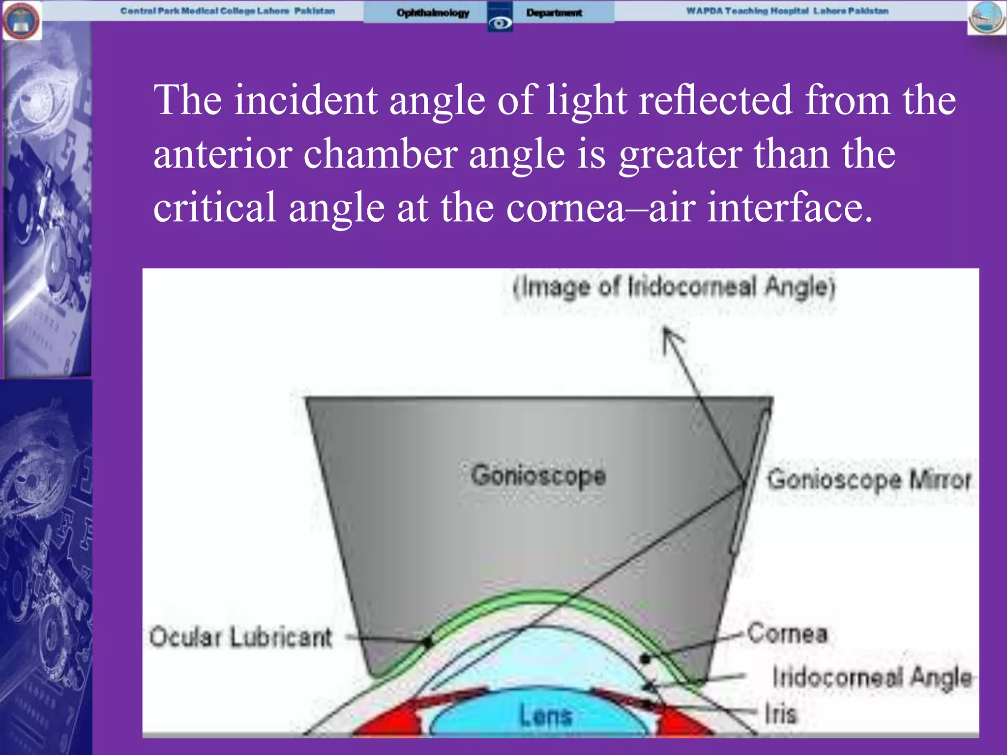 The incident angle of light reﬂected from the
anterior chamber angle is greater than the
critical angle at the cornea–air interface.
 