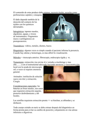 El contenido de estas produce daño extenso, necrosis tisular, secuelas como
perforaciones septales y sinequias.
El daño depende también de la
duración del contacto de los
tejidos con los químicos
derramados.
Iatrogénicos: tapones nasales,
algodones, agujas, y trozos
de instrumentos. Fragmentos
óseos o cartilaginosos en
postoperatorios.
Traumáticos: vidrios, metales, dientes, hueso.
Diagnóstico: algunas veces es simple cuando el paciente informa la presencia.
Cuando hay edema y hemorragia, es mas difícil la visualización.
Métodos = rinoscopia anterior, fibroscopía, endoscopia rígida y rx.
Tratamiento: extracción; (no enviar el c/ extraño a rinofaringe y mas
allá.........) con el instrumental adecuado haciendo anestesia y vasoconstricción
local con la ayuda de microscopio
orl; a veces se requiere anestesia
general.
Animados: instilación de solución
suave con éter y extracción.
Cirugía
Consideraciones especiales: las
baterías en fosas nasales, son casos
que requieren extracción urgente,
posterior desbridamiento y atb
locales.
Las semillas requieren extracción pronta >> se hinchan, se ablandan y se
deshacen.
Todo cuerpo extraño en nariz se debe extraer después del diagnóstico en
forma pronta para evitar su cambio de posición y alojamiento en vías aéreas
inferiores o digestivas.
 