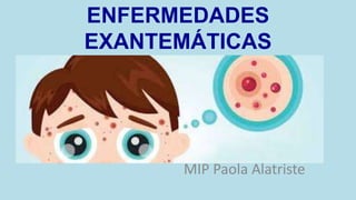 ENFERMEDADES
EXANTEMÁTICAS
MIP Paola Alatriste
 