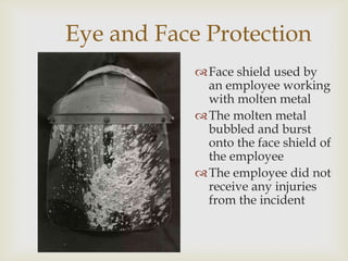 Eye and Face Protection
Face shield used by
an employee working
with molten metal
The molten metal
bubbled and burst
onto the face shield of
the employee
The employee did not
receive any injuries
from the incident
 