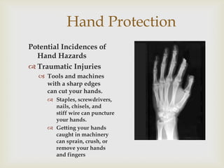 Hand Protection
Potential Incidences of
Hand Hazards
 Traumatic Injuries
 Tools and machines
with a sharp edges
can cut your hands.
 Staples, screwdrivers,
nails, chisels, and
stiff wire can puncture
your hands.
 Getting your hands
caught in machinery
can sprain, crush, or
remove your hands
and fingers
 