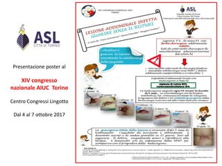 Presentazione poster al
XIV congresso
nazionale AIUC Torino
Centro Congressi Lingotto
Dal 4 al 7 ottobre 2017
 