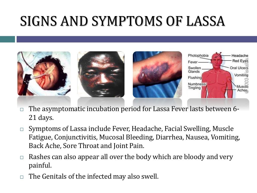 UNDERSTANDING LASSA FEVER
