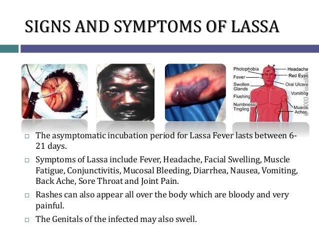 UNDERSTANDING LASSA FEVER understanding-lassa-fever