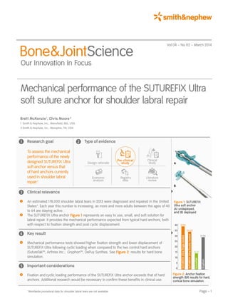 Page – 1*Worldwide procedural data for shoulder labral tears are not available.
Mechanical performance of the SUTUREFIX Ultra
soft suture anchor for shoulder labral repair
Brett McKenzie 1
, Chris Moore 2
1	Smith & Nephew, Inc., Mansfield, MA, USA
2	Smith & Nephew, Inc., Memphis, TN, USA
	 Research goal
To assess the mechanical
performance of the newly
designed SUTUREFIX Ultra
soft anchor versus that
of hard anchors currently
used in shoulder labral
repair.1
Figure 1: SUTUREFIX
Ultra soft anchor
(A) undeployed,
and (B) deployed
A
B
40 37.95
35 34.62
30 27.95
25
20
15 13.97
10
5
0
SUTUREFIXUltraSingleloaded
SUTUREFIXUltraDoubleloaded
SutureTak
Gryphon
*smith&nephew
Vol  04 – No  02 – March 2014
Design rationale
Clinical
study
Economic
analysis
Registry
data
Literature
review
Pre-clinical
study
Figure 2: Anchor fixation
strength (lbf) results for hard,
cortical bone simulation.
Bone&JointScience
 Our Innovation in Focus
	 Type of evidence
	 Clinical relevance
	An estimated 178,000 shoulder labral tears in 2013 were diagnosed and repaired in the United
States*. Each year this number is increasing, as more and more adults between the ages of 40
to 64 are staying active.
	The SUTUREFIX Ultra anchor Figure 1 represents an easy to use, small, and soft solution for
labral repair. It provides the mechanical performance expected from typical hard anchors, both
with respect to fixation strength and post cyclic displacement.
	 Key result
	Mechanical performance tests showed higher fixation strength and lower displacement of
SUTUREFIX Ultra following cyclic loading when compared to the two control hard anchors
(SutureTakTM
, Arthrex Inc.; GryphonTM
, DePuy Synthes. See Figure 2: results for hard bone
simulation.
	 Important considerations
	Fixation and cyclic loading performance of the SUTUREFIX Ultra anchor exceeds that of hard
anchors. Additional research would be necessary to confirm these benefits in clinical use.
Pre-clinical
study
 
