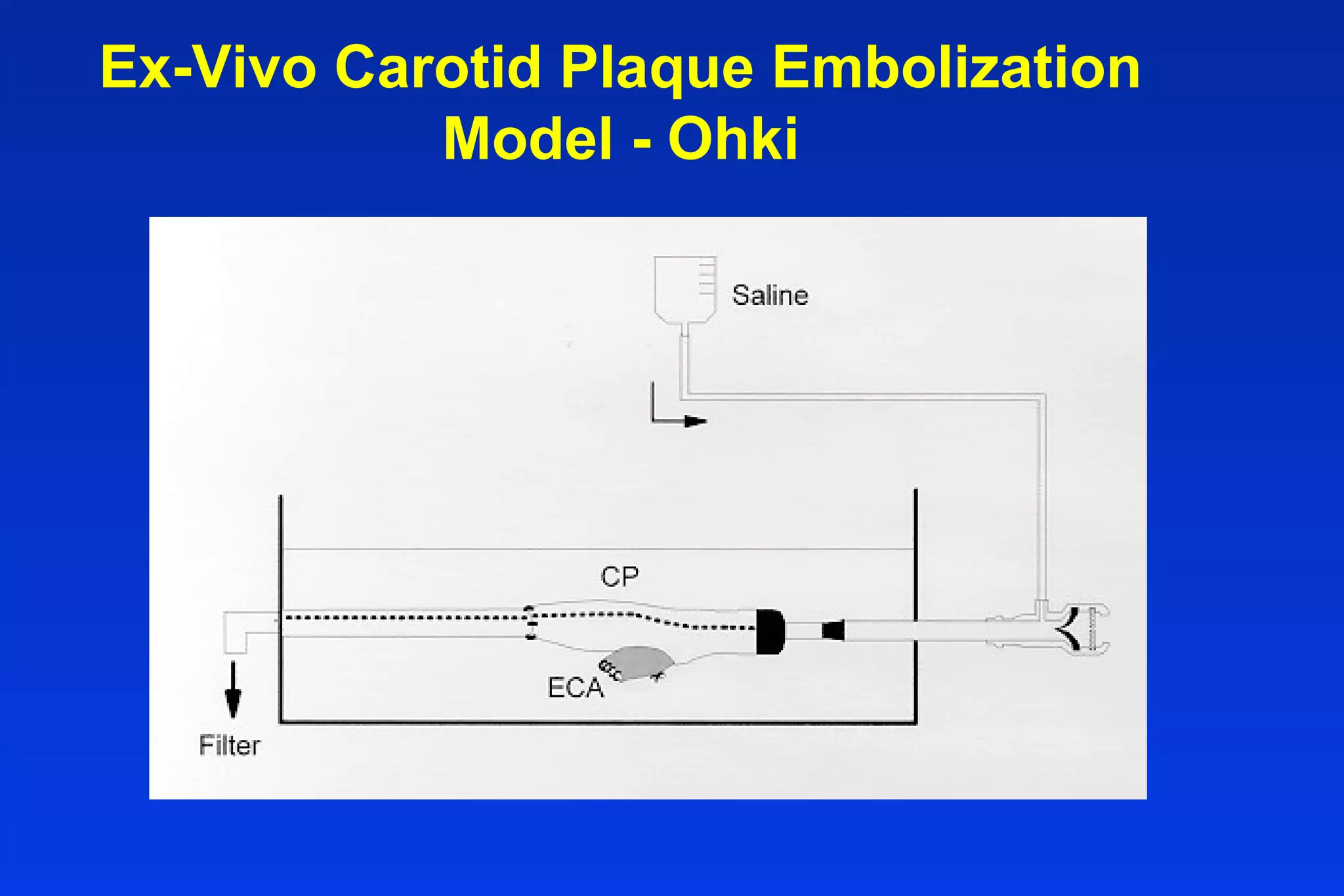 Ex-Vivo Carotid Plaque Embolization
Model - Ohki
 