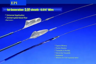 1st Generation 3.9F sheath - 0.014” Wire
Capture Efficiency
Particle Retention
Trackability & Flexibility
One to One Torquability
Radiopacity
Withdraws into 0.035” angioplasty balloon
Universal Application
Uninterrupted blood flow
( 80µm pores )
EPI
 