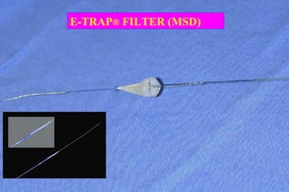 E-TRAP® FILTER (MSD)
 