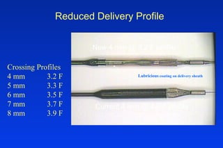Reduced Delivery Profile
New 4 mm @ 3.2 F profile
Current 4 mm @ 4.6 F profile
Crossing Profiles
4 mm 3.2 F
5 mm 3.3 F
6 mm 3.5 F
7 mm 3.7 F
8 mm 3.9 F
Lubricious coating on delivery sheath
 